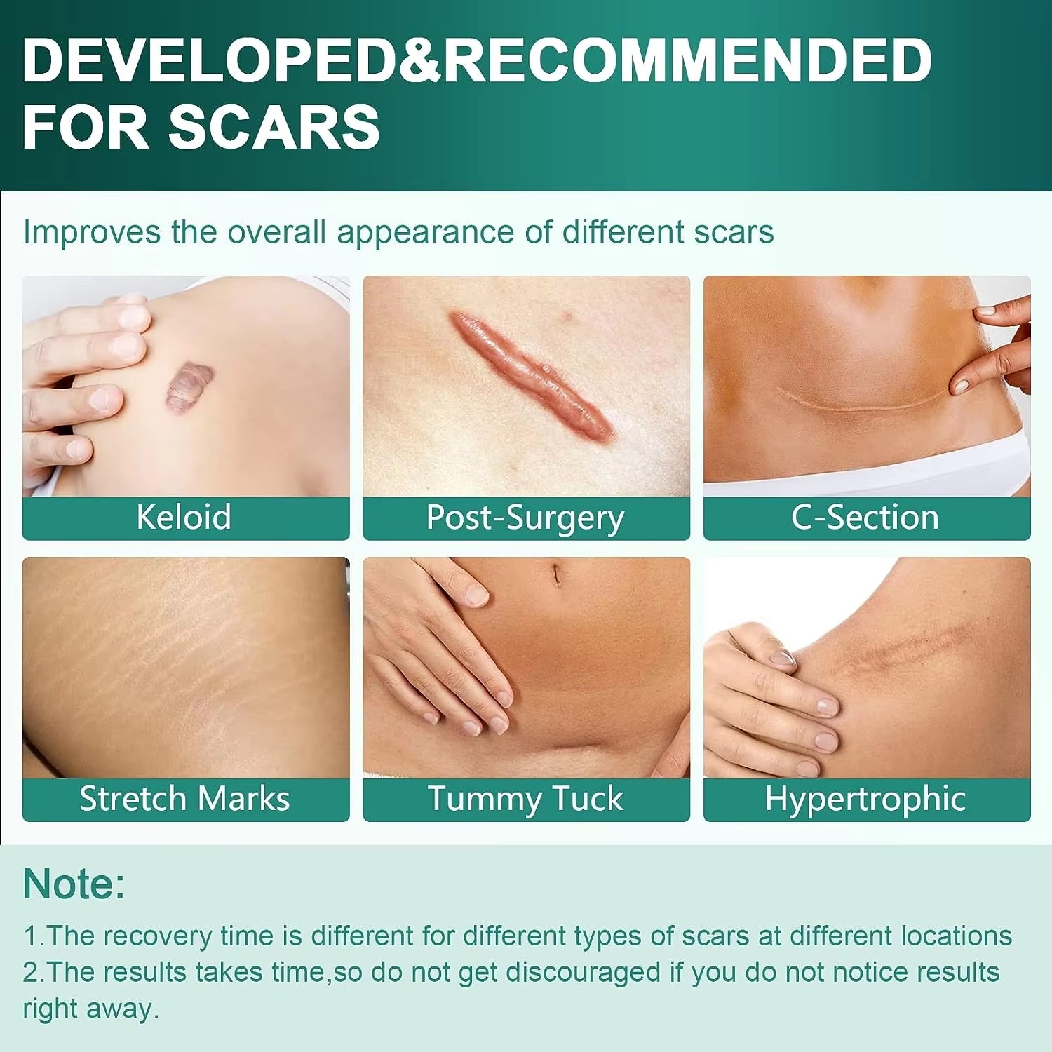 50/100/150cm Silicone Gel Scar - Medical Tape 评论和价格