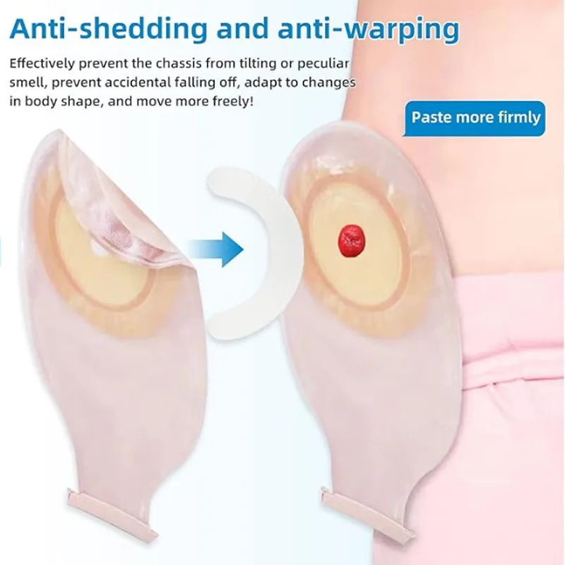 Medical Ostomy Bag Reinforceme - Medical Tape 评论和价格